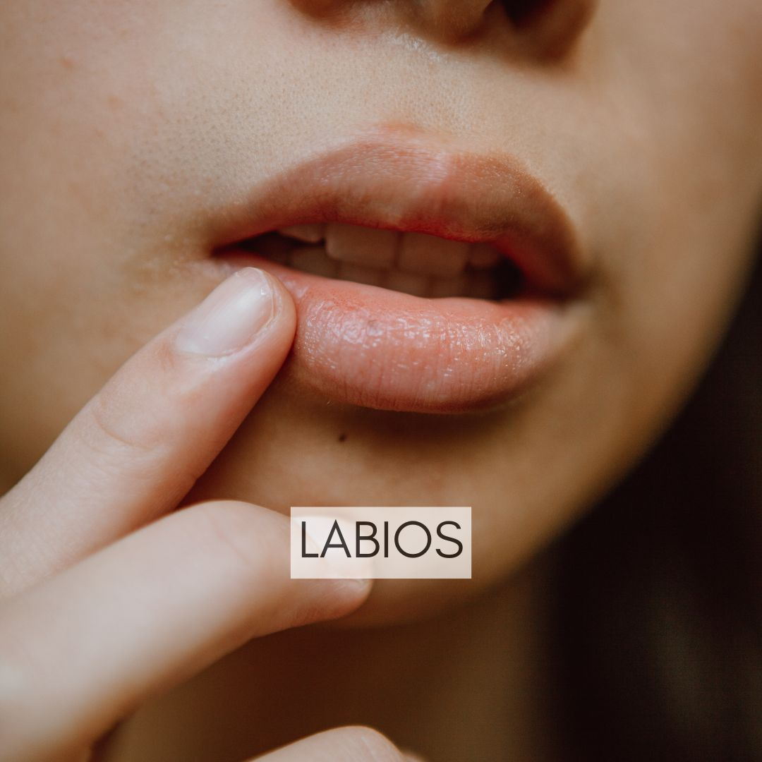 Labios