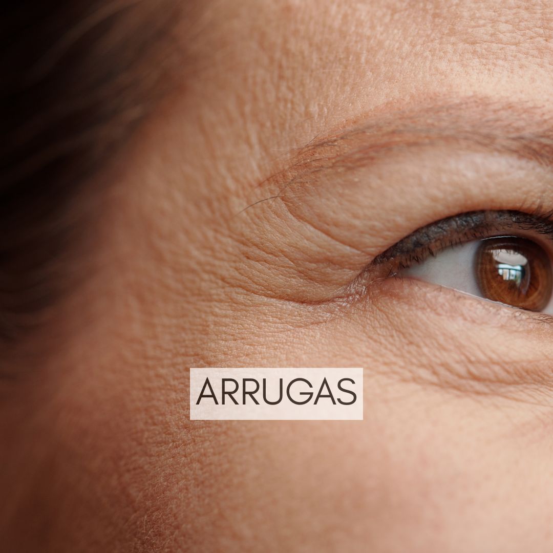 Arrugas