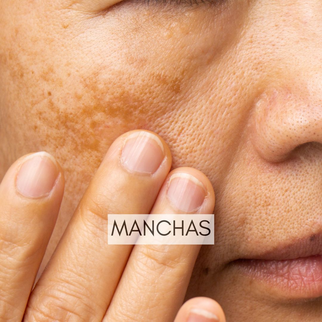 Manchas